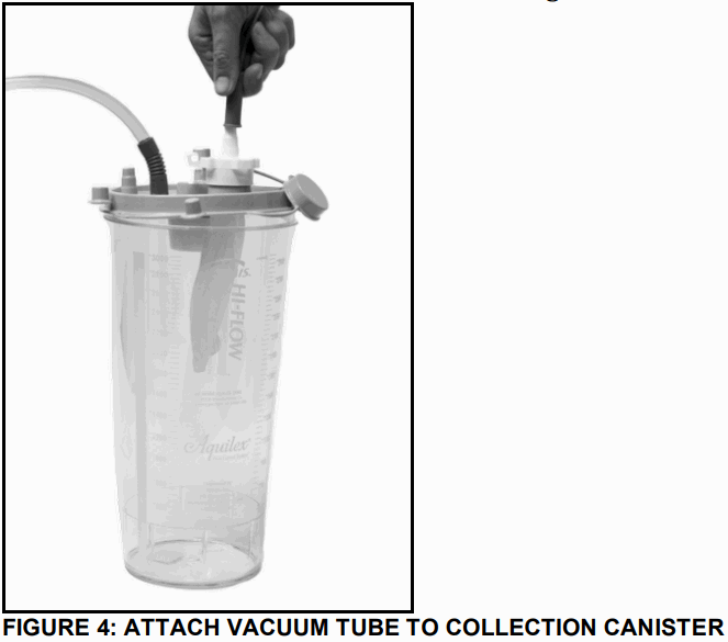 stryker Reprocessed MyoSure Tissue Removal Device - FIGURE 4