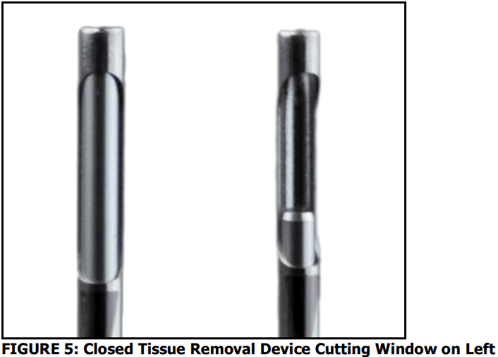 stryker Reprocessed MyoSure Tissue Removal Device - FIGURE 5