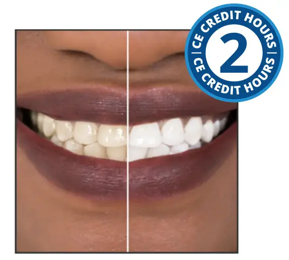DentalCare What to Know About Whitening - Figure 1