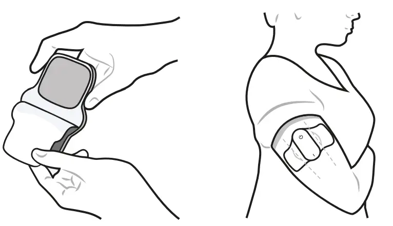 Nerivio-1-Prescribed-Drug-Free-Treatment-for-Migraine-fig-6