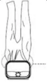 weasy Basic Clothes Drying Function User Guide - Put the nylon balloon on