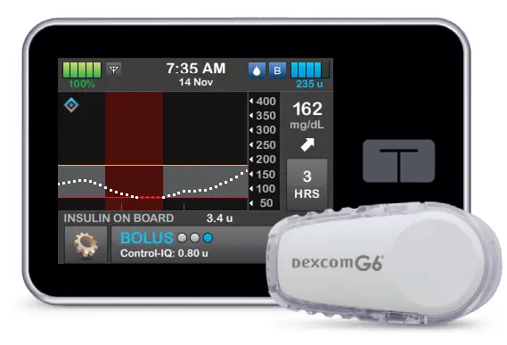 TANDEM Connecting the Dexcom G6 CGM Transmitter to the t slim X2 Insulin Pump - Connection