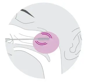 Ag Test Instructions