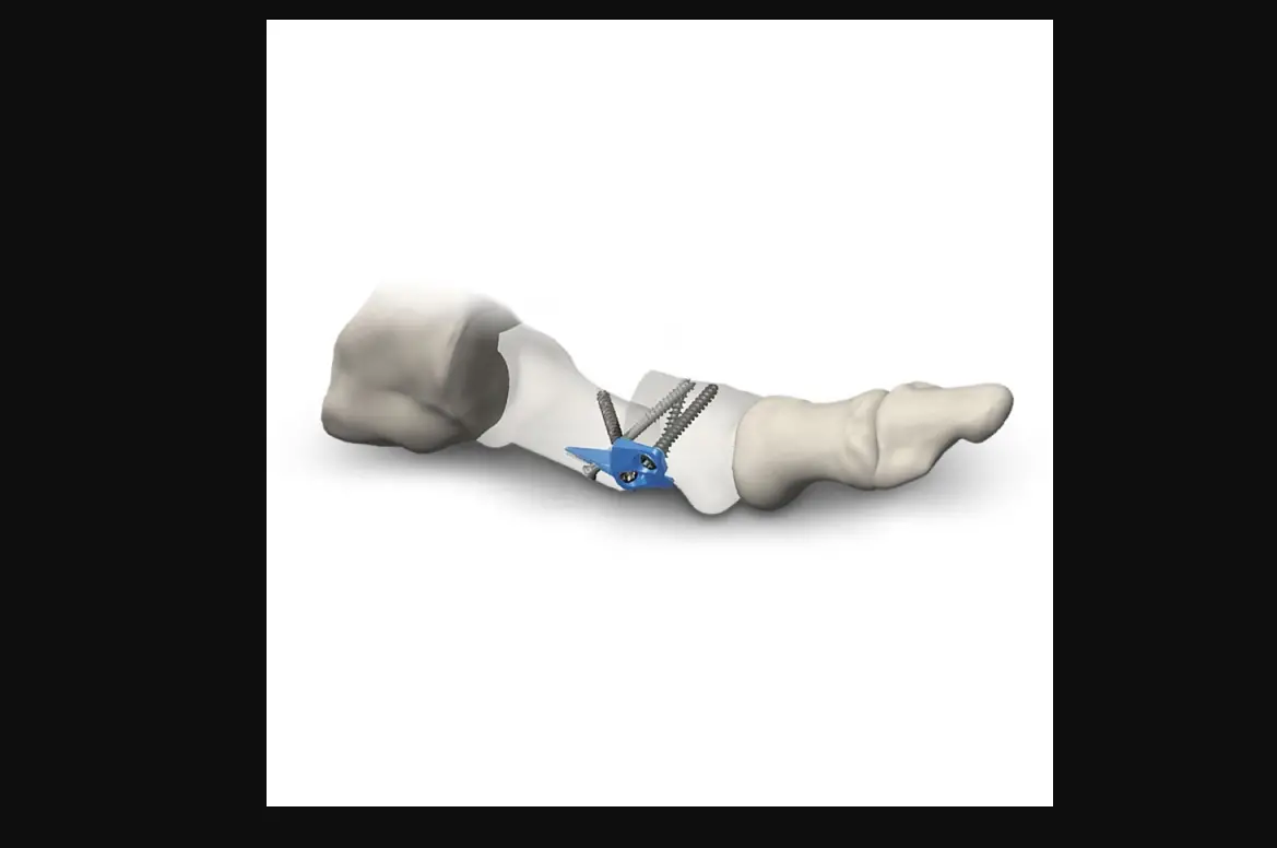 Djo M.i.b. Plating System User Guide