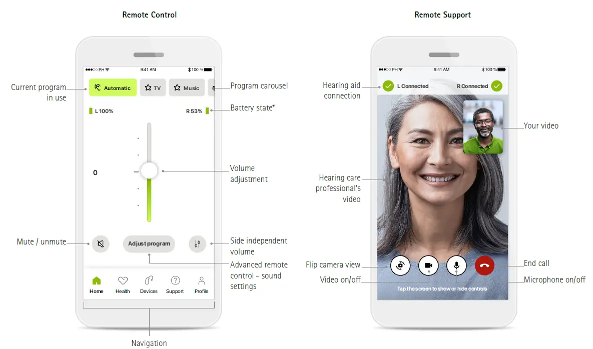 MyPhonak Hearing Aid App 1