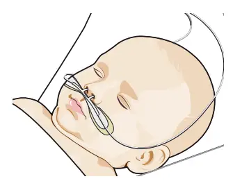 CPAP MAN AIRVO 2 Water Spray Humidifier - fig 2