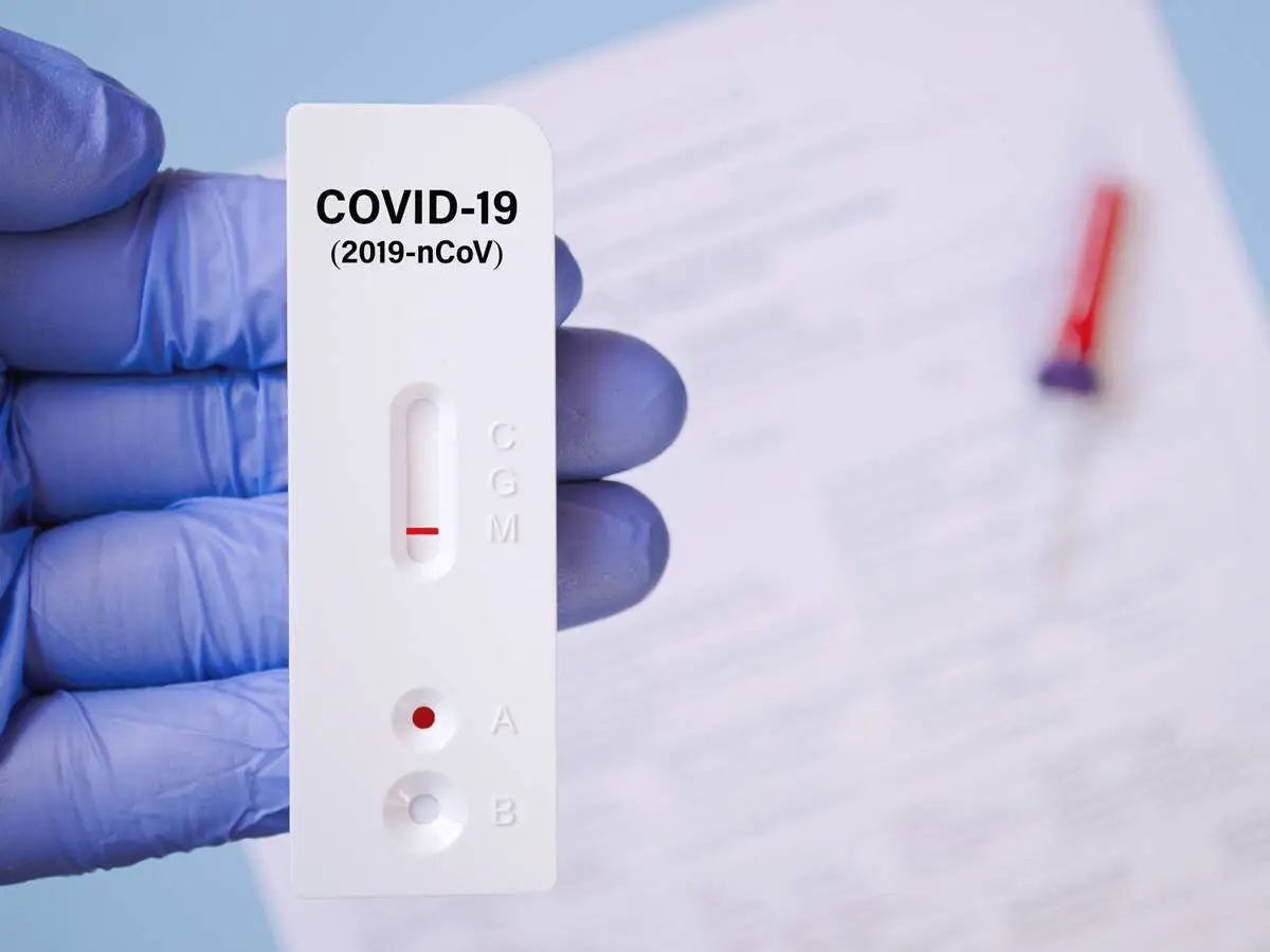Sars-cov-2 Antigen Rapid Test Kit (colloidal Gold) Instructions For Use