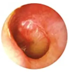 Doctor-Mom-Otoscope-BCBI10052-LED-Pocket-Pro-fig-3