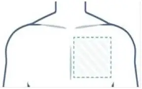 LifeSignals LX1550 Multi Parameter Remote Monitoring Platform-FIG17