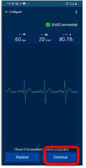 LifeSignals LX1550 Multi Parameter Remote Monitoring Platform-FIG28