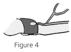yuwell 140603 Sphygmomanometer Aneroid User Manual - Figure 4