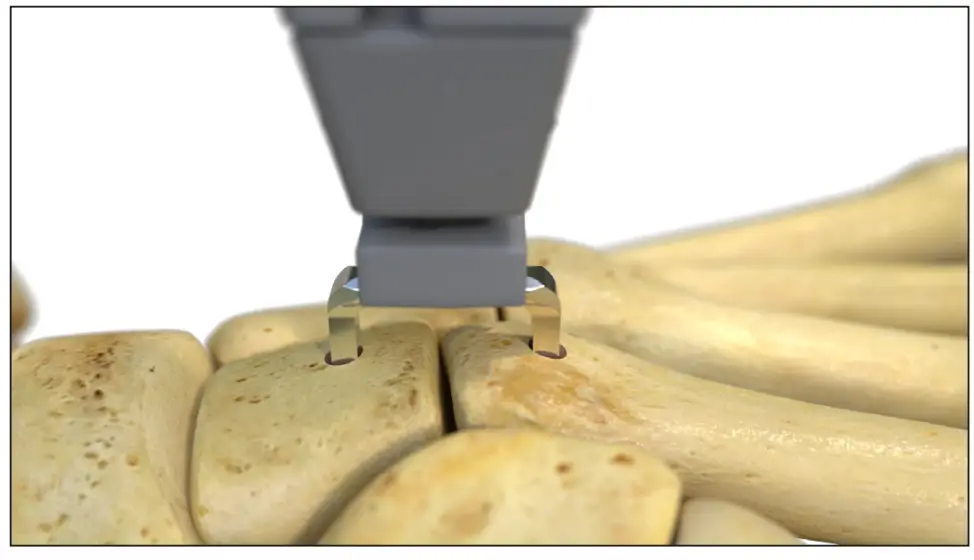 Final seat and fluoro check