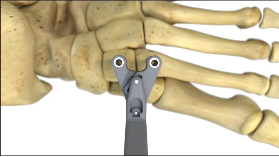 Universal Drill Guide