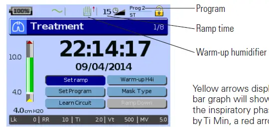 ResMed-Stellar-150-Series-Non-Invasive-Ventilator-6