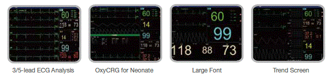 Edan iM8 Series Patient Monitor fig-3