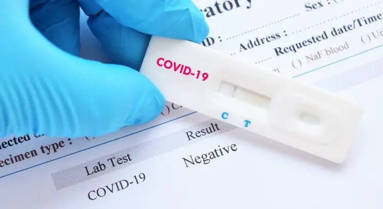 Prognosis Lateral Flow Test For Covid-19 / Ag 2019-ncov Instructions For Use Prognosis Lateral Flow Test For Covid-19 / Ag 2019-ncov Instructions For Use