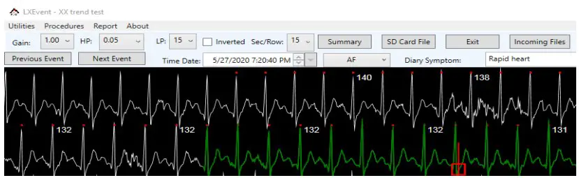 X Event Operator’s Manual