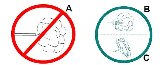 Hill-Rom NP100 Bidensity High Resilience Foam Mattress-7