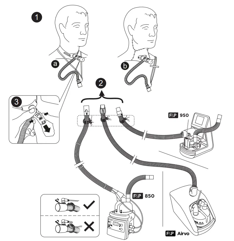 FISHER-PAYKEL-OPT970-Optiflow+-Tracheostomy-Direct-Connection-fig-1