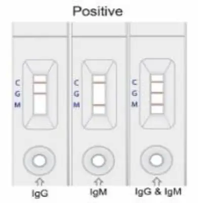 Artron-COVID-19-IgM-IgG-AntibodyTest-FIG-6