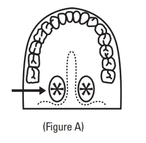 microlife MT1612 60Second Basal Thermometer - vaginal