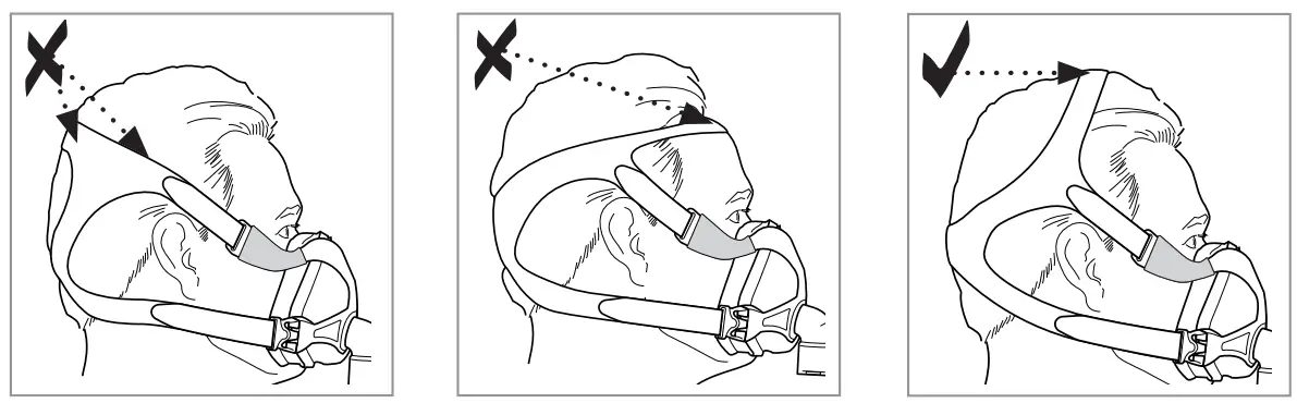 RESMED S61742 Quattro FX NV Full Face Mask - fig 1