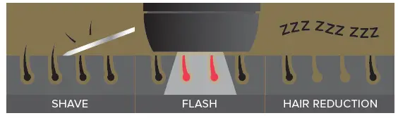 SMOOTHSKIN-pure-Mini-IPL-FIG 2