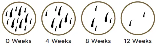 SMOOTHSKIN-pure-Mini-IPL-FIG 3