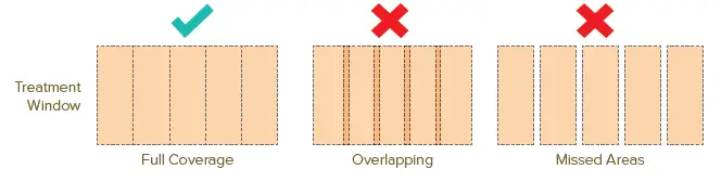 SMOOTHSKIN-pure-Mini-IPL-FIG 9