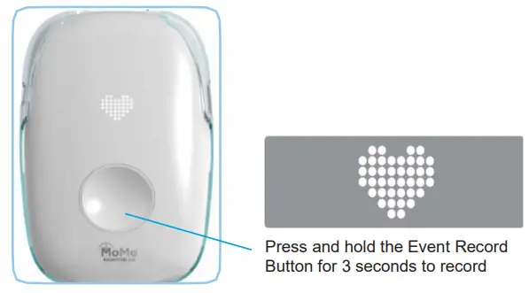 MoMe Kardia 3 In 1 Automated Cardiac Monitoring System - Event Record