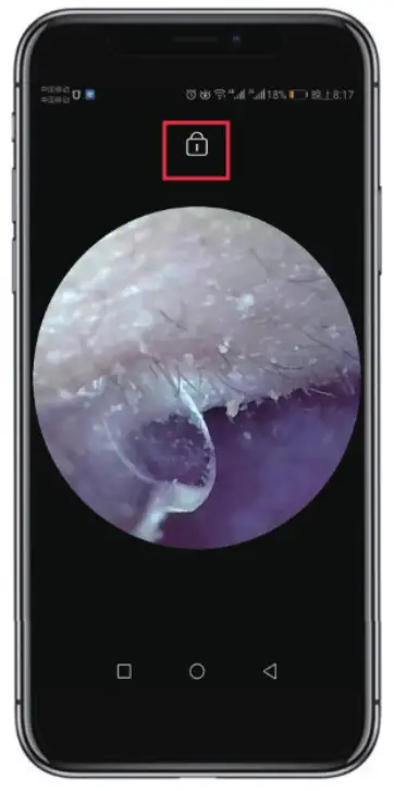 eutto Professional Otoscope- 08