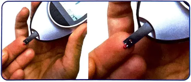 Dr Morepen BG-03 Blood Glucose Test Strips - MONITORING BLOOD GLUCOSE 4