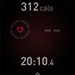 FIG 58 Heart-rate signal missing