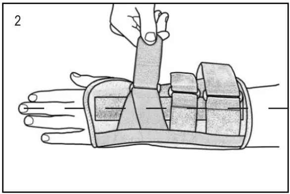 HELY WEBER Universal Wrist Orthosis Short Long 439 - Fig 2