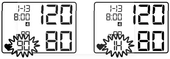 SureLife 08496021201 Wrist Premium BPM User Manual - Irregular Heartbeat