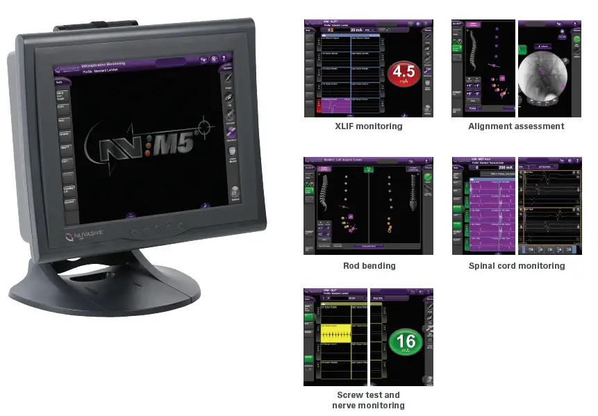 NUVASIVE-2022-NVM5-Intraoperative-Neuromonitoring-FIG-1