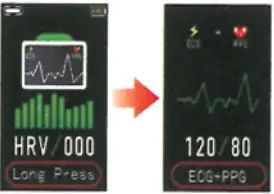mangrove Smart Bracelet - ECG interface
