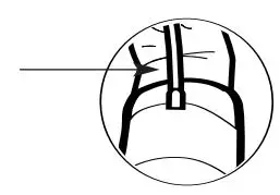 FIG 14 USING THE ARM CUFF