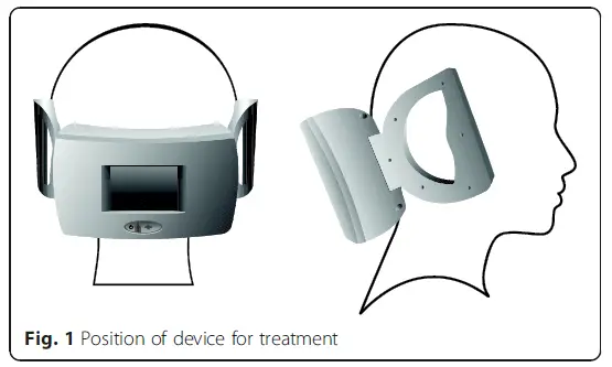 SPRING-TMS-Single-Pulse-Transcranial-Magnetic-FIG-1