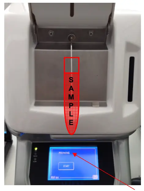 ALIFAX SI R20-MC Automatic ESR Analyze - Fig 43