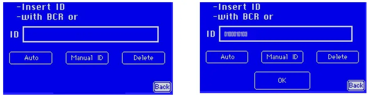 ALIFAX SI R20-MC Automatic ESR Analyze - Fig 45