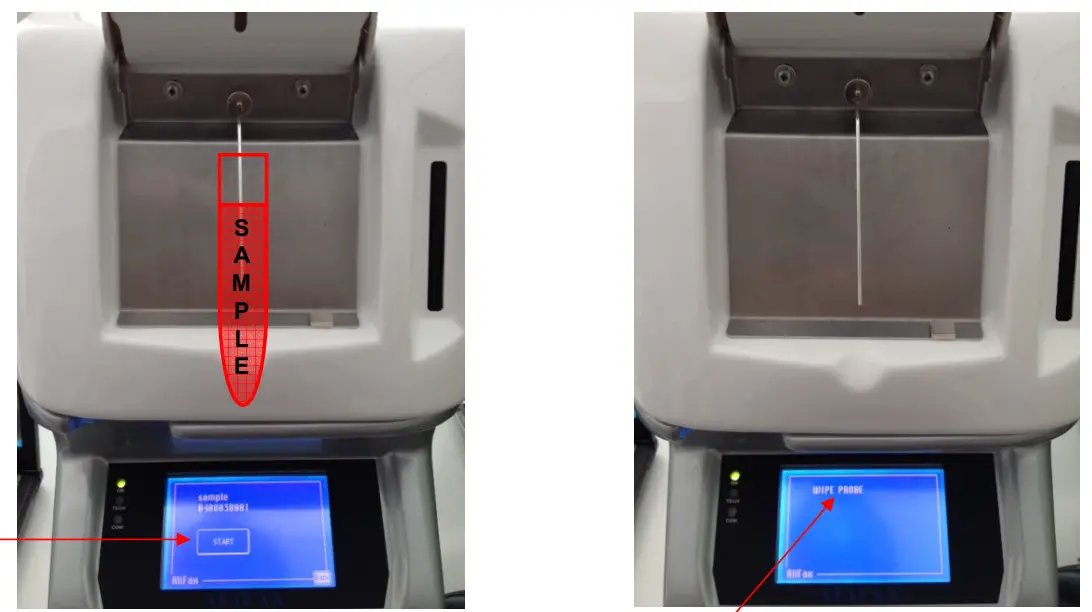 ALIFAX SI R20-MC Automatic ESR Analyze - Fig 49
