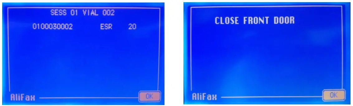 ALIFAX SI R20-MC Automatic ESR Analyze - Fig 50