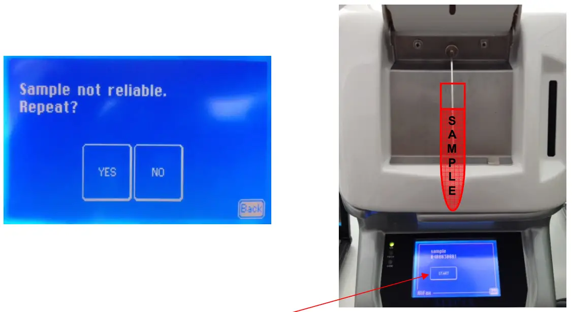 ALIFAX SI R20-MC Automatic ESR Analyze - Fig 53