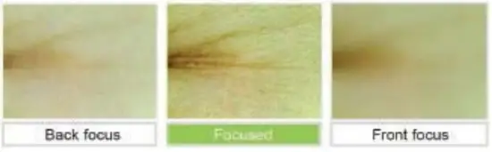 CHOWIS CDP 020 A Diagnosis System - Camera Focaced