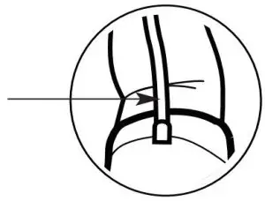 FIG 13 USING THE ARM CUFF