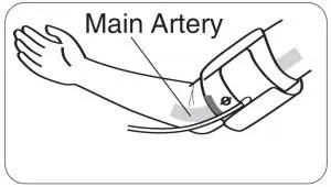 FIG 16 Main Artery