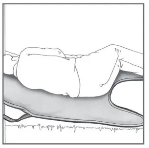 HUMAN CARE 25064-JM Comfort Sling Soft - fig 17