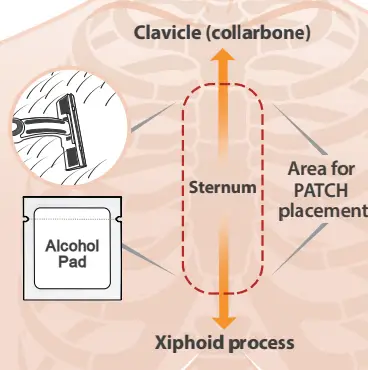 Lifelens 2AXAK100006 Wireless ECG Monitor Kit 7