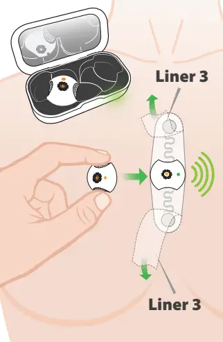 Lifelens 2AXAK100006 Wireless ECG Monitor Kit 9